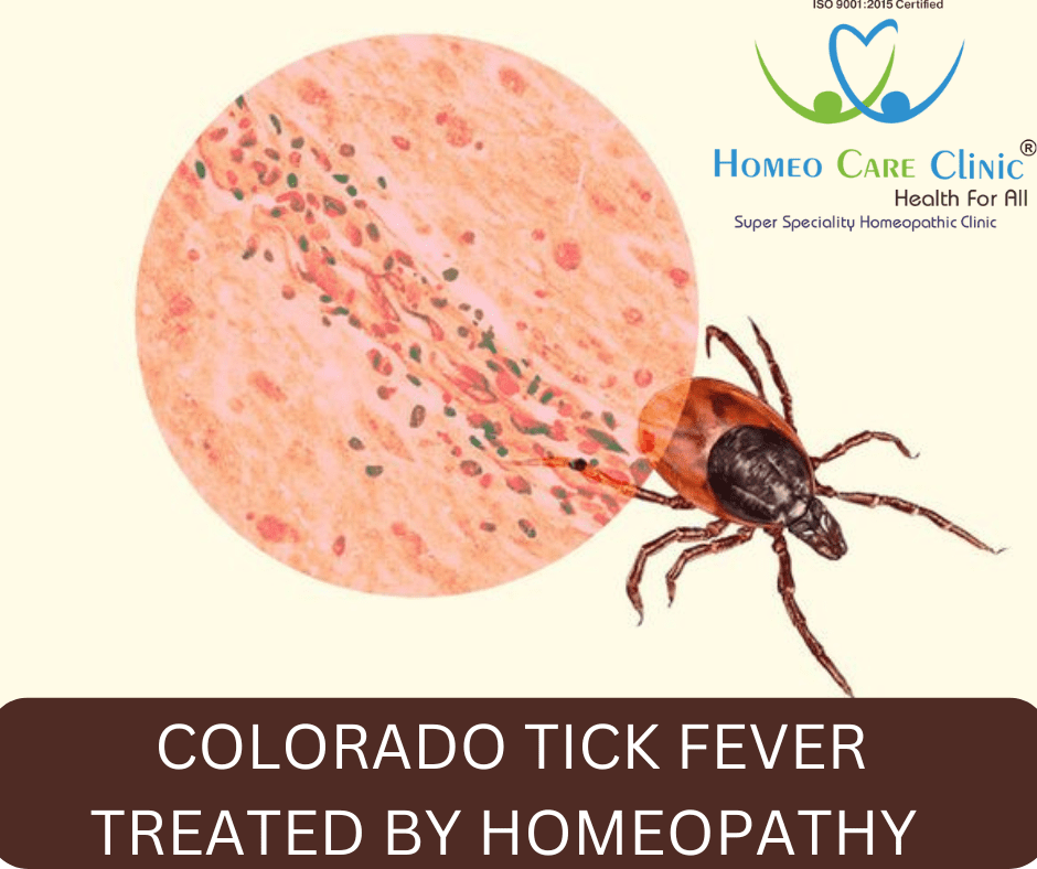 Colorado Tick Fever