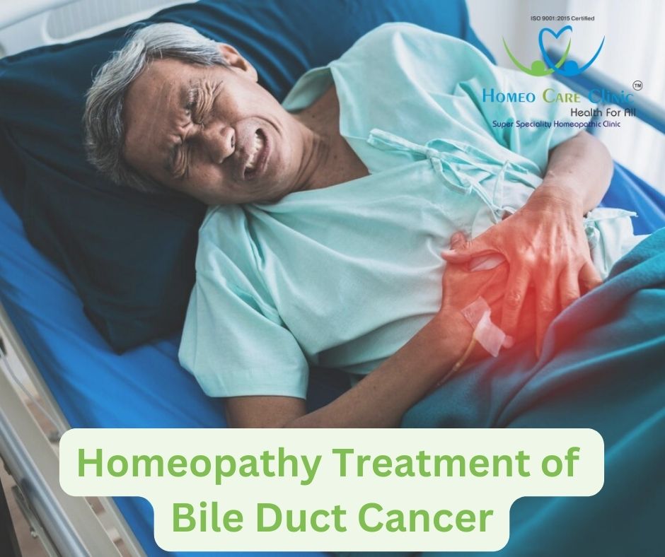 Bile-Duct-Cancer