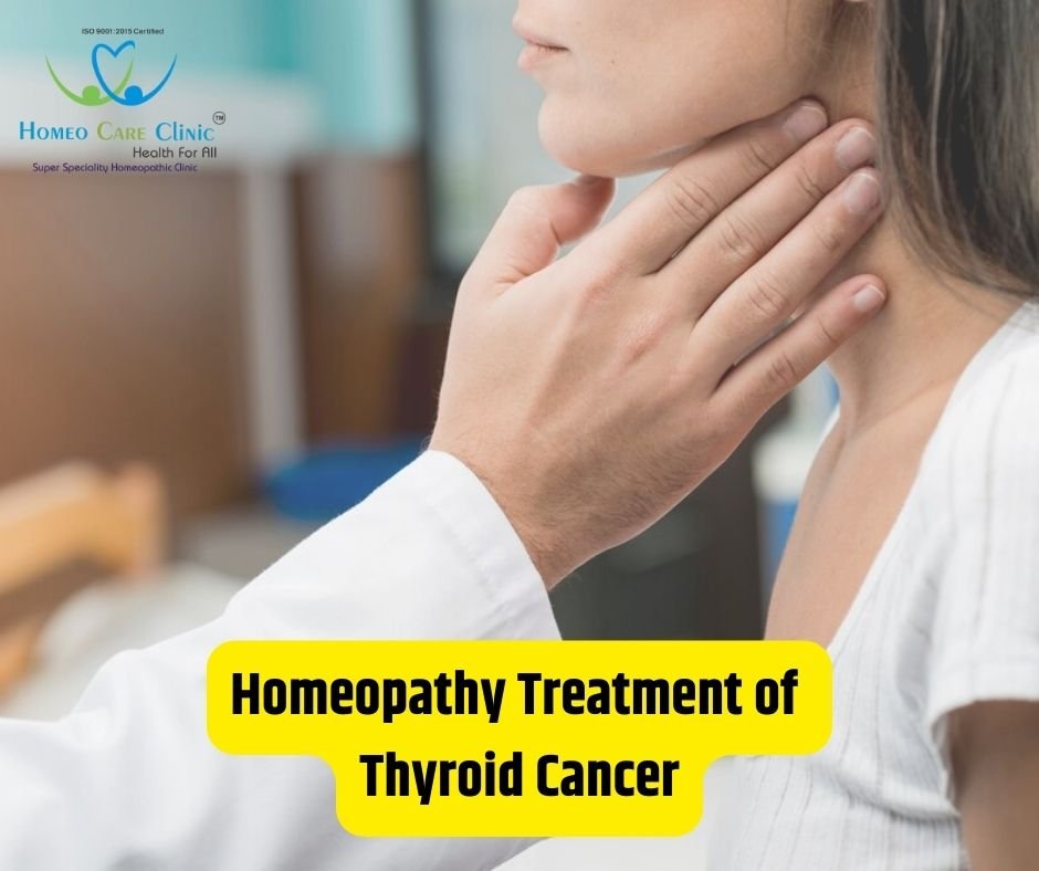 homeopathy treatment of thyroid cancer
