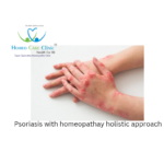 Treating Psoriasis Holistically with Homeopathy