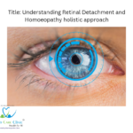 Homeopathic Remedies for Retinal Detachment Explained