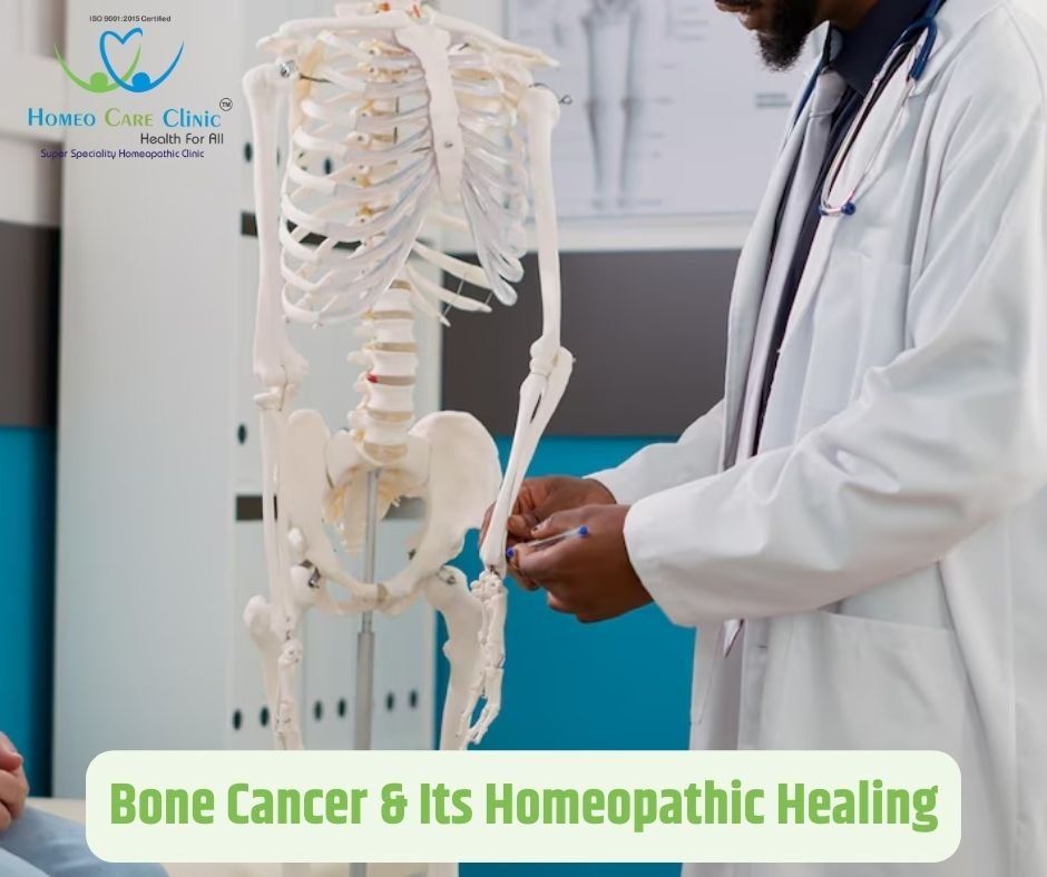 Bone Cancer & Its Homeopathic Healing