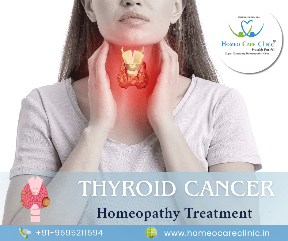 Thyroid cancer