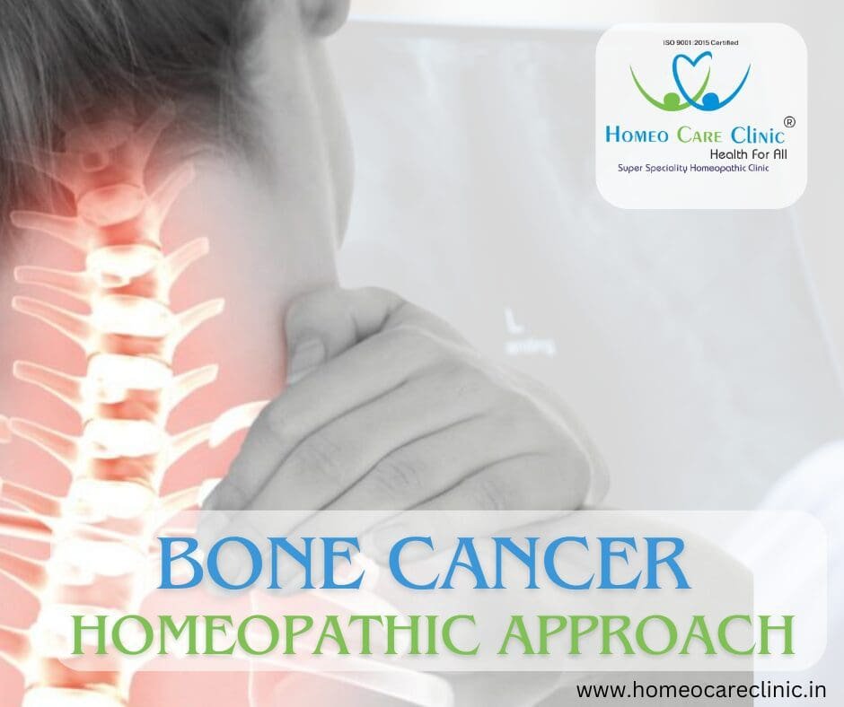 Homeopathic consultation for bone cancer treatment at Homeo Care Clinic