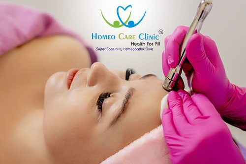 Laser Hair Removal