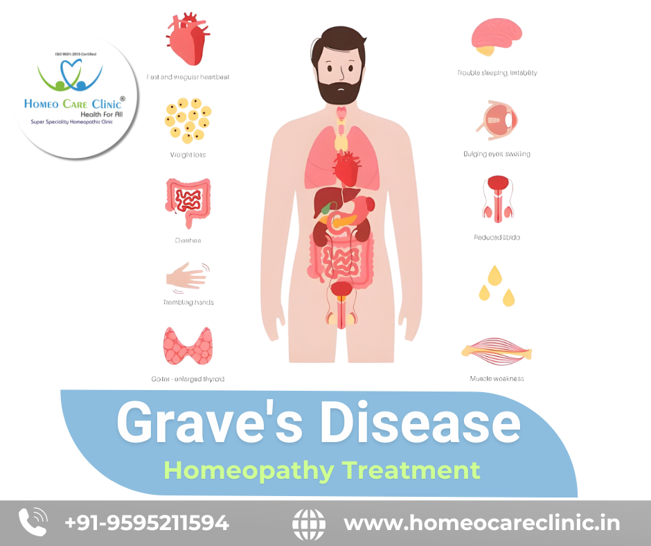 Graves' Disease