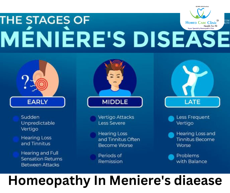 Causes of Meniere's Disease