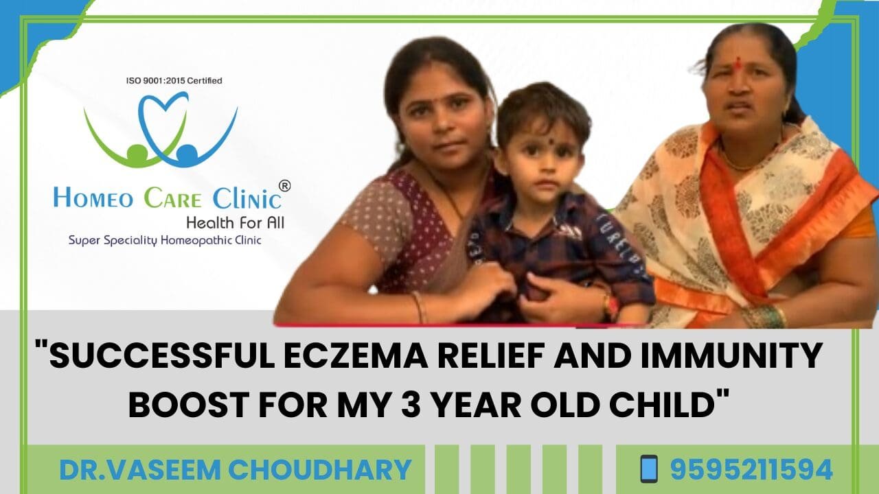 Homeopathy treatment for eczema recovery