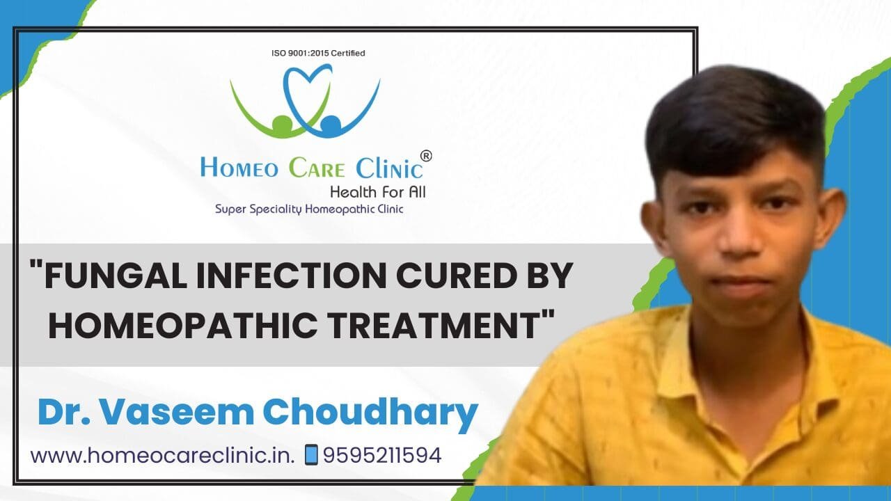Psoriasis homeopathy treatment