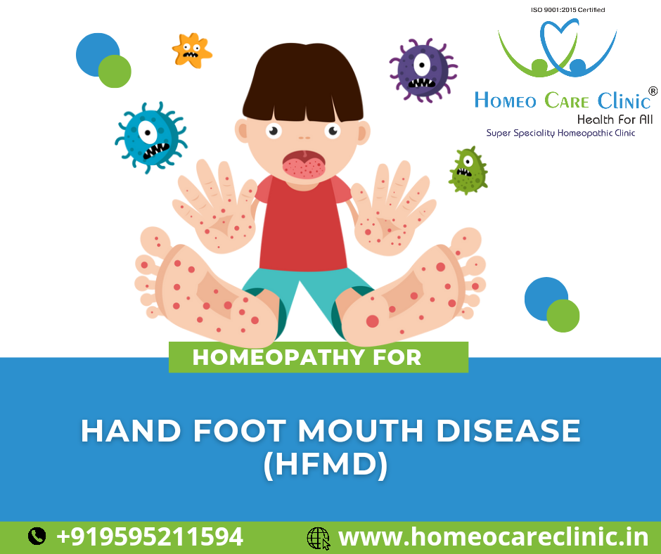 Homeopathic HFMD treatment remedies