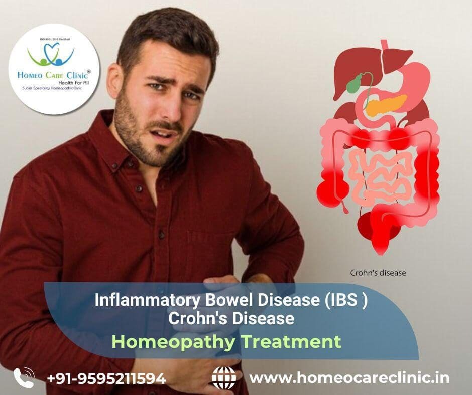 Homeopathic treatment for colitis