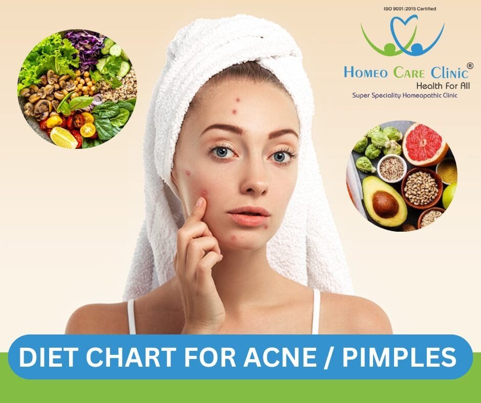 Diet chart with foods to eat and avoid for clear skin diet chart for reducing acne and pimples