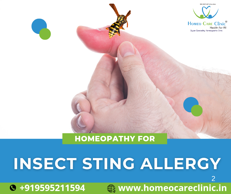 Homeopathic remedies for insect sting allergy relief, natural treatments.