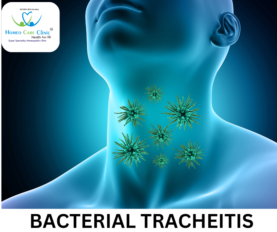 remedies for bacterial tracheitis