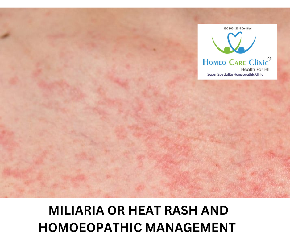 symptoms of Miliaria