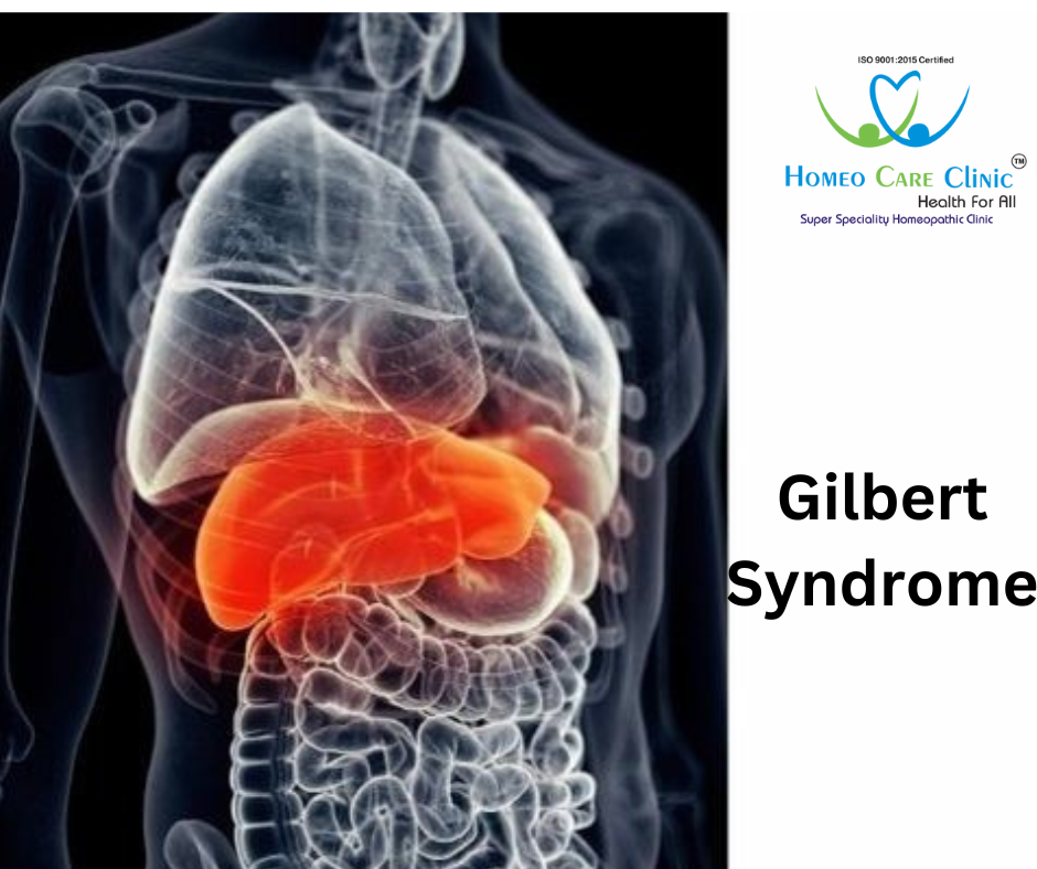 Gilbert syndrome risk factors