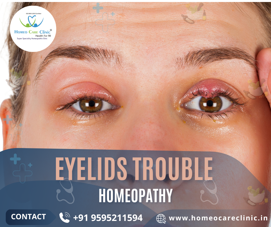 Relief from eyelid troubles