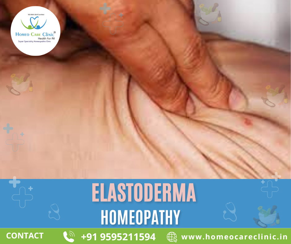 skin elasticity issues caused by Elastoderma