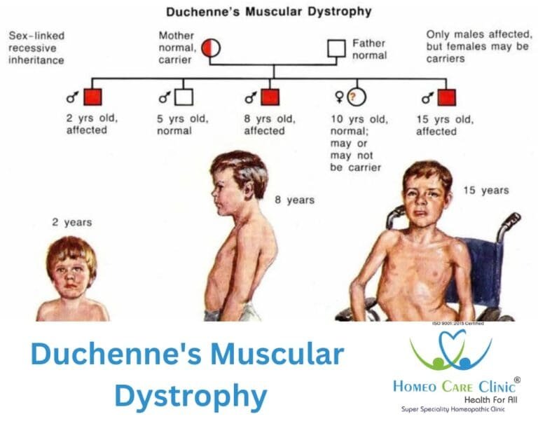 Duchenne Muscular Dystrophy Symptoms Causes And Treatment Options Duchenne Muscular Dystrophy Symptoms Causes And Treatment Options