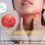 Tonsillopharyngitis Homeopathy Treatment