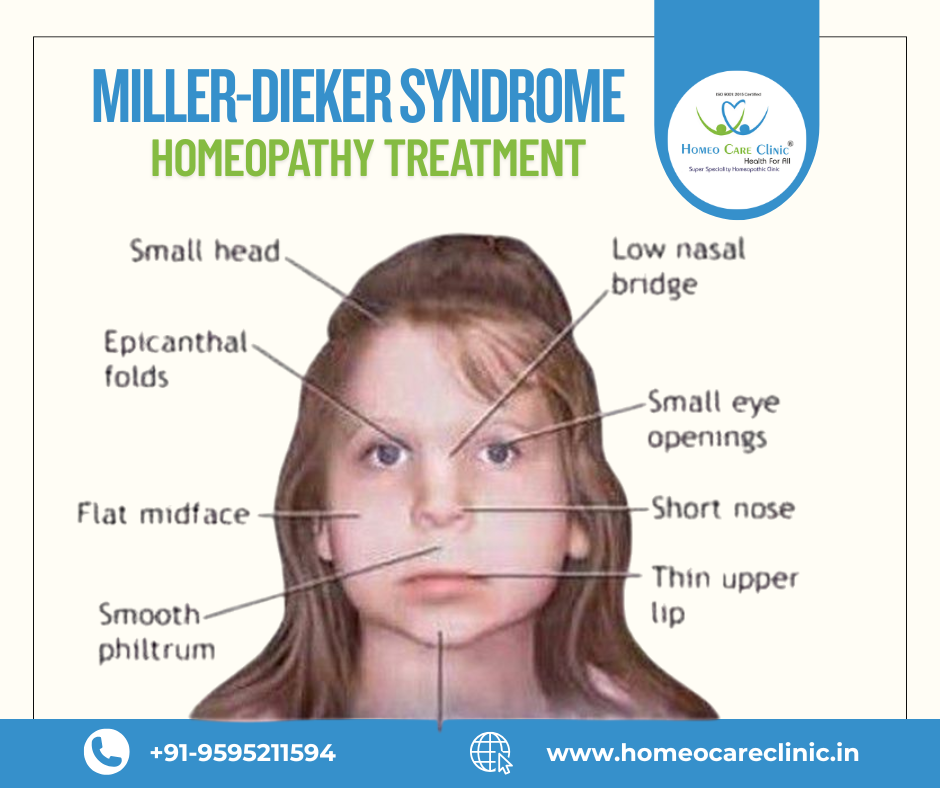 Homeopathic remedies for Miller-Dieker Syndrome treatment