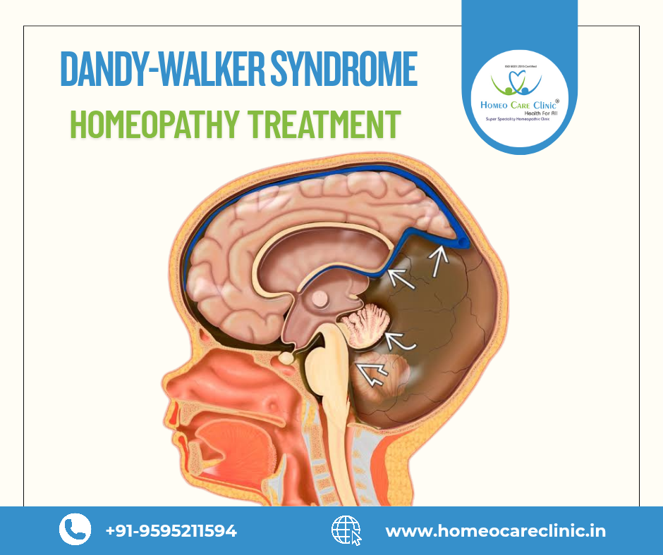 Dandy-Walker Syndrome brain scan with homeopathy