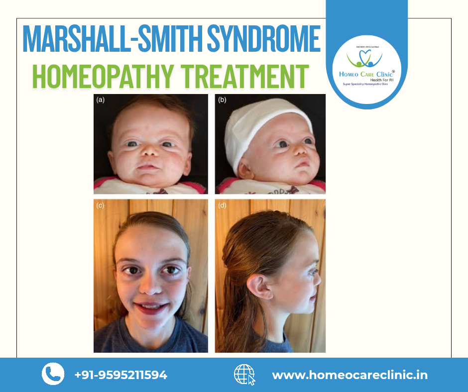 Marshall-Smith Syndrome homeopathic solution