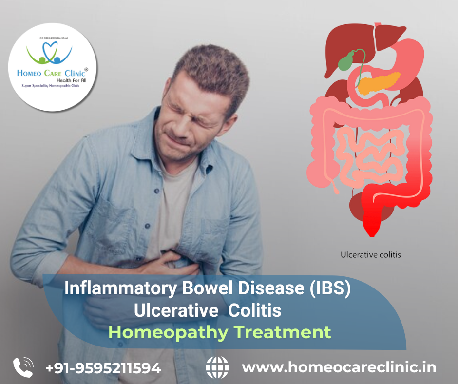 Ulcerative colitis homeopathic treatment