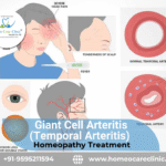 Homeopathic Cure for Giant Cell Arteritis