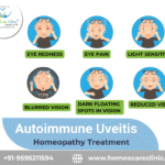 Autoimmune Uveitis Treatment
