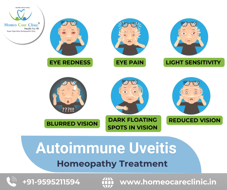Autoimmune Uveitis Treatment