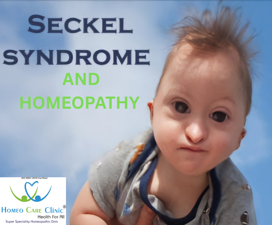 Seckel Syndrome overview