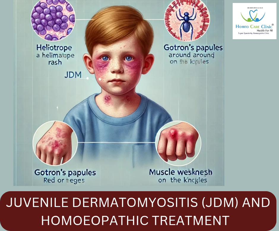 JDM Homeopathy Treatment