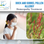 Dock and Sorrel pollen allergy
