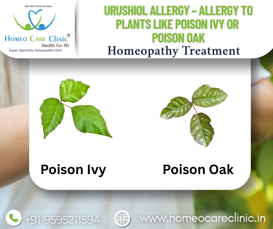 Urushiol from Poison Ivy plant