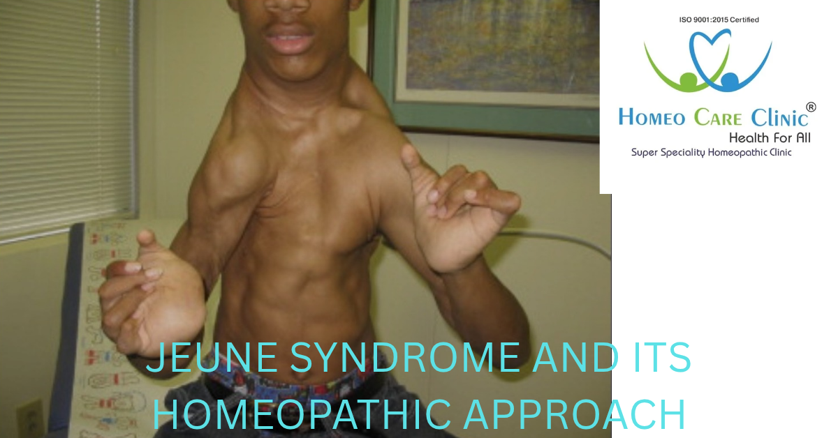 Jeune Syndrome Cuases and Symptoms