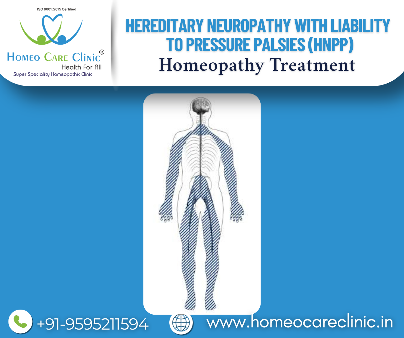Hereditary Neuropathy with Liability to Pressure Palsies