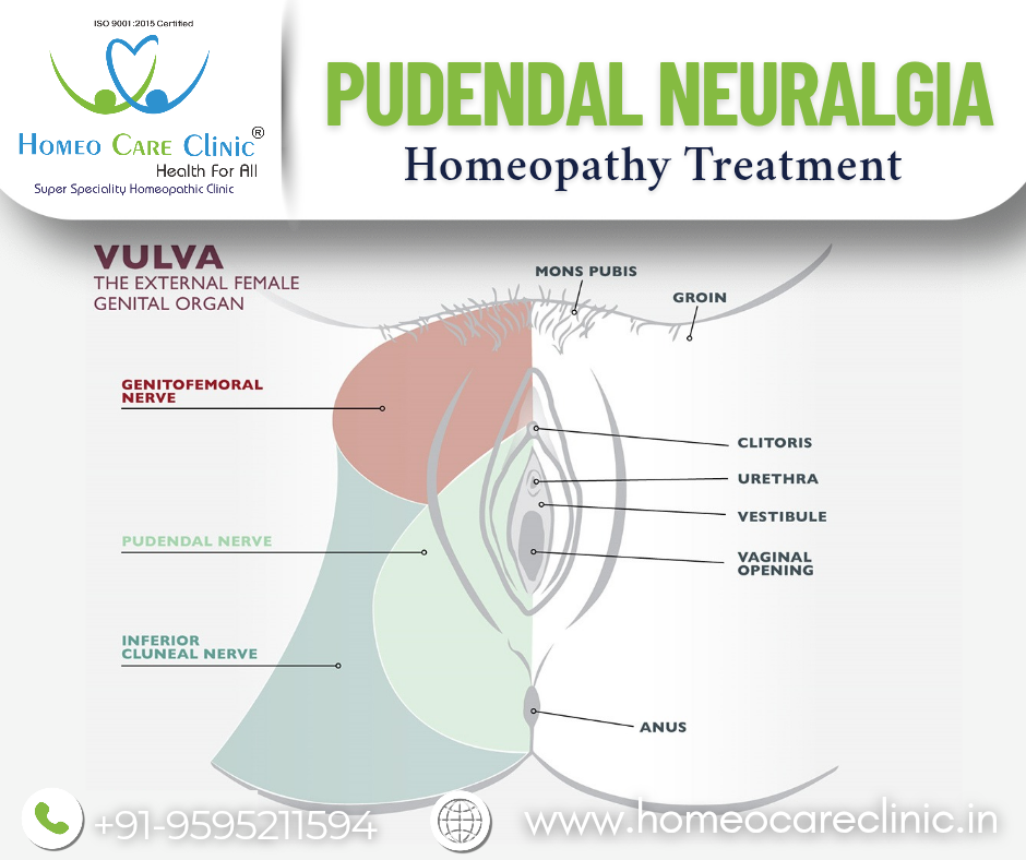 pudendal neuralgia treatment