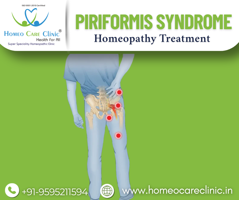 Piriformis Syndrome Causes and Symptoms