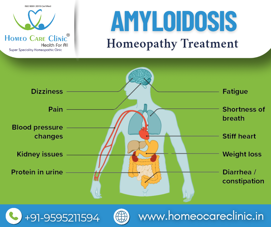 Amyloidosis Causes and Symptoms