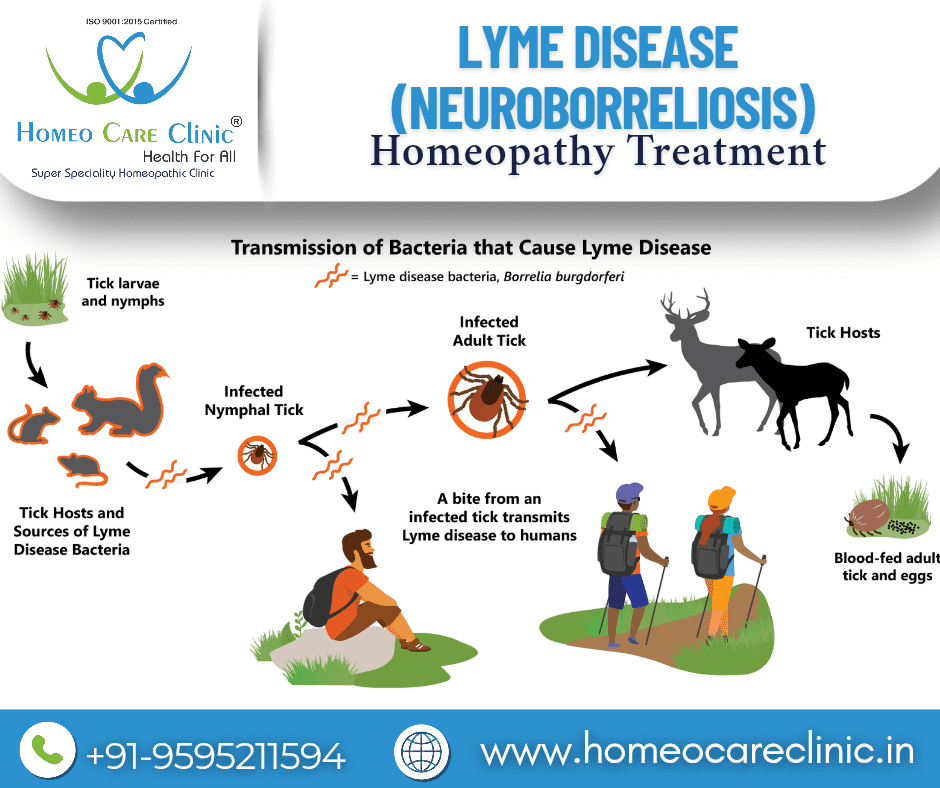Lyme disease neuroborreliosis