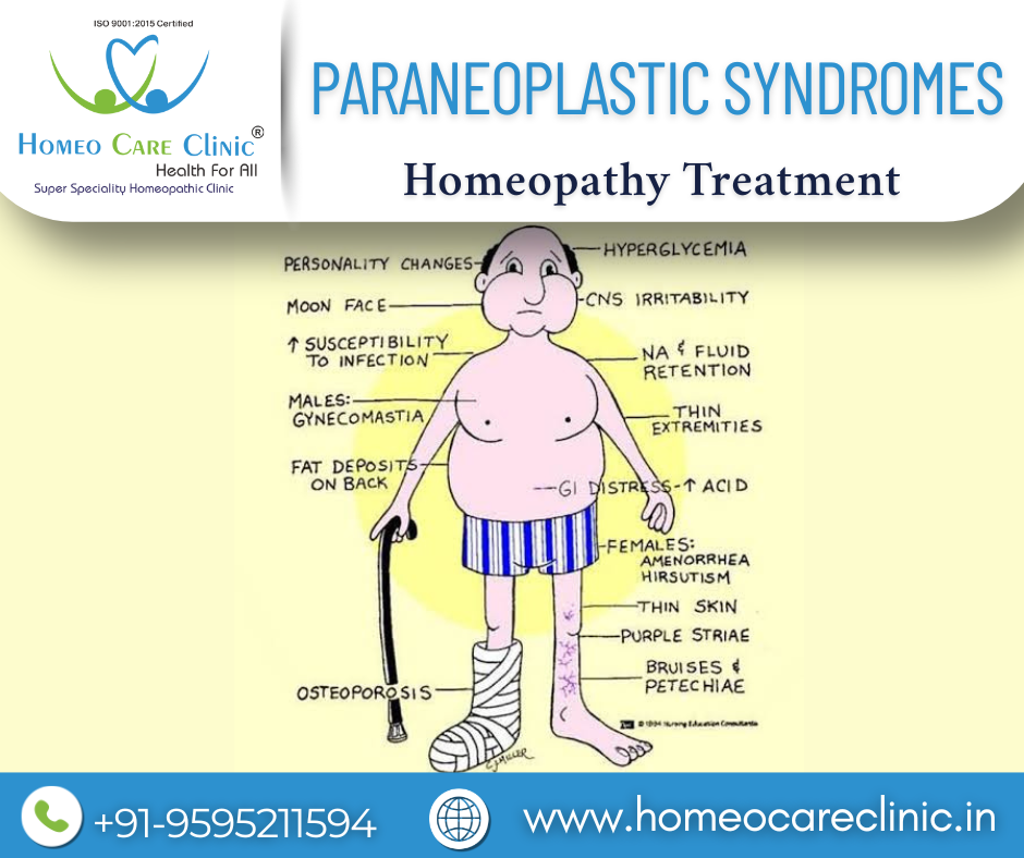 Paraneoplastic syndrome treatment