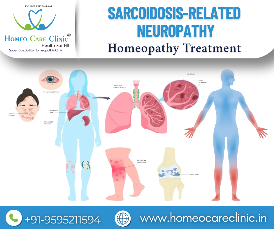 Sarcoidosis-related neuropathy