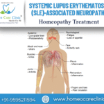 SLE-associated neuropathy symptoms