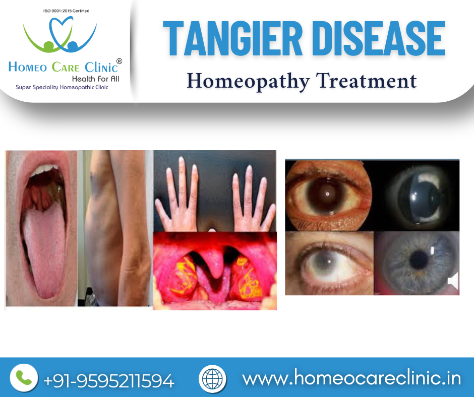 tangier disease symptoms