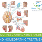 Multiple Cranial Nerve Palsies Causes and Symptoms