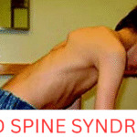 Rigid Spine Syndrome: Symptoms & Causes