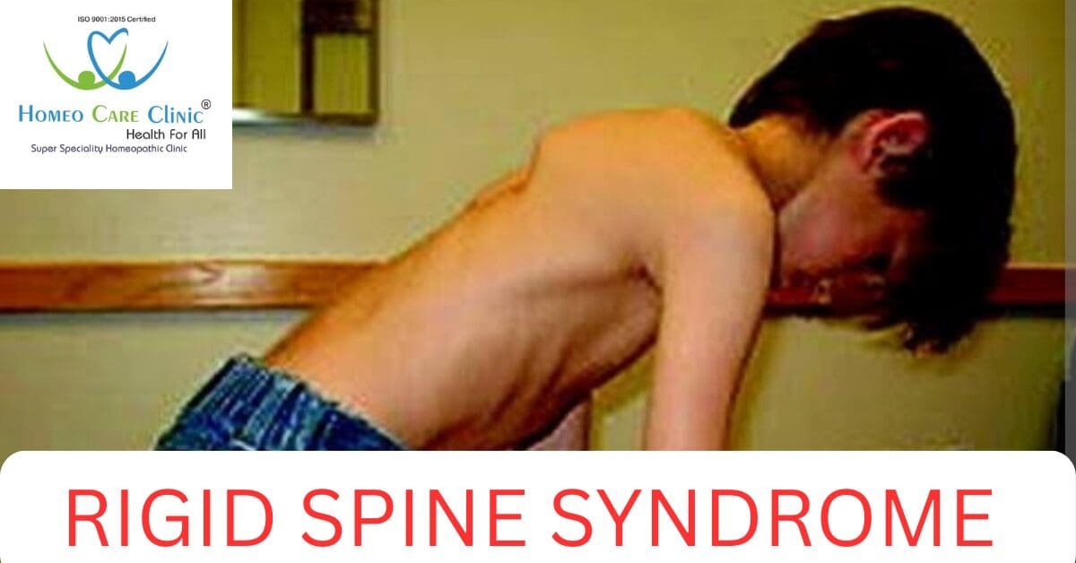 Rigid Spine Syndrome: Symptoms & Causes