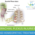 Brachial Plexus Injuries and Its Causes