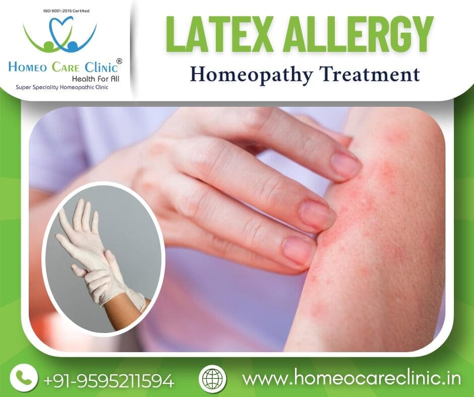 Latex Allergy – Natural Healing
